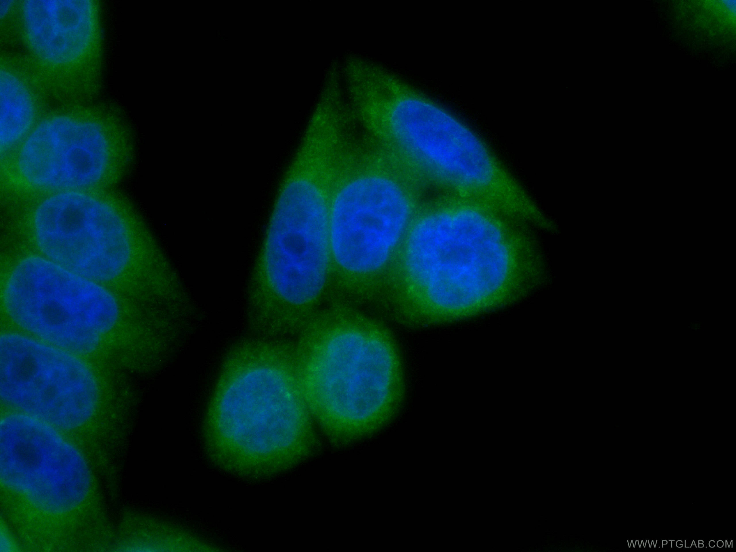 Immunofluorescence (IF) / fluorescent staining of HeLa cells using CoraLite® Plus 488-conjugated LPCAT1 Monoclonal an (CL488-66044)