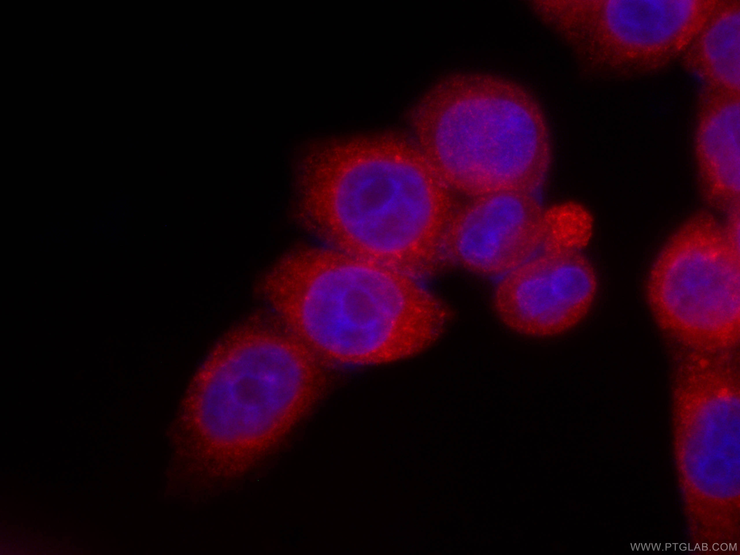 Immunofluorescence (IF) / fluorescent staining of HeLa cells using CoraLite®594-conjugated LPCAT1 Monoclonal antibody (CL594-66044)