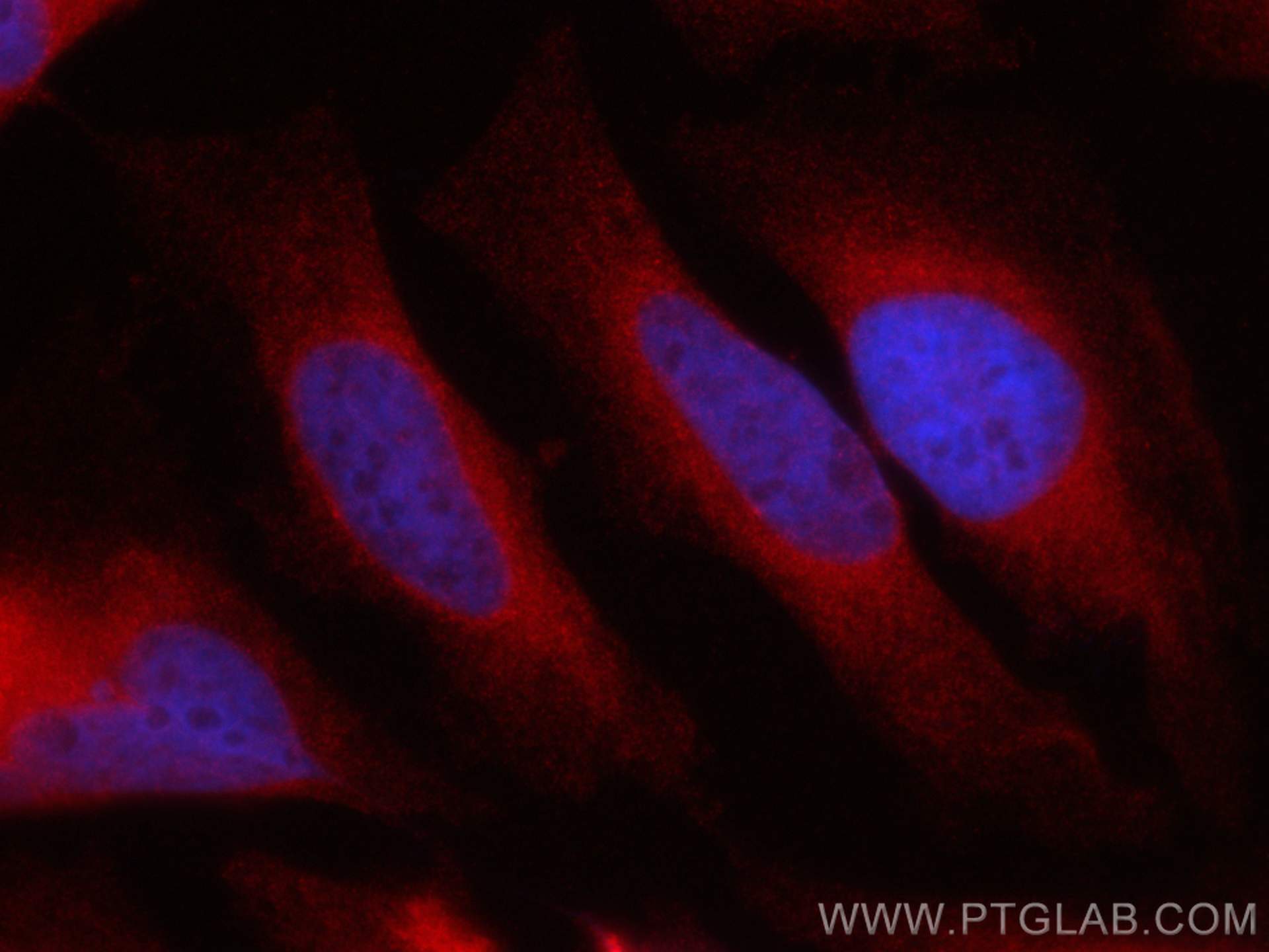 Immunofluorescence (IF) / fluorescent staining of HeLa cells using CoraLite®594-conjugated LPCAT1 Monoclonal antibody (CL594-66044)