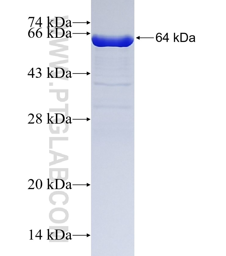 LPCAT1 fusion protein Ag9035 SDS-PAGE