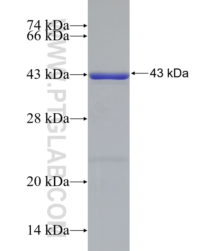 LPCAT1 fusion protein Ag9060 SDS-PAGE