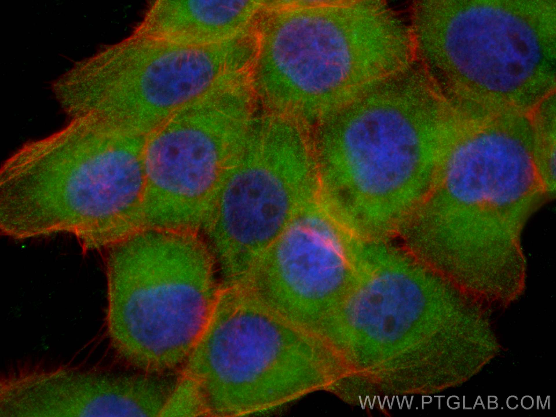 Immunofluorescence (IF) / fluorescent staining of A431 cells using LPCAT2 Polyclonal antibody (15082-1-AP)