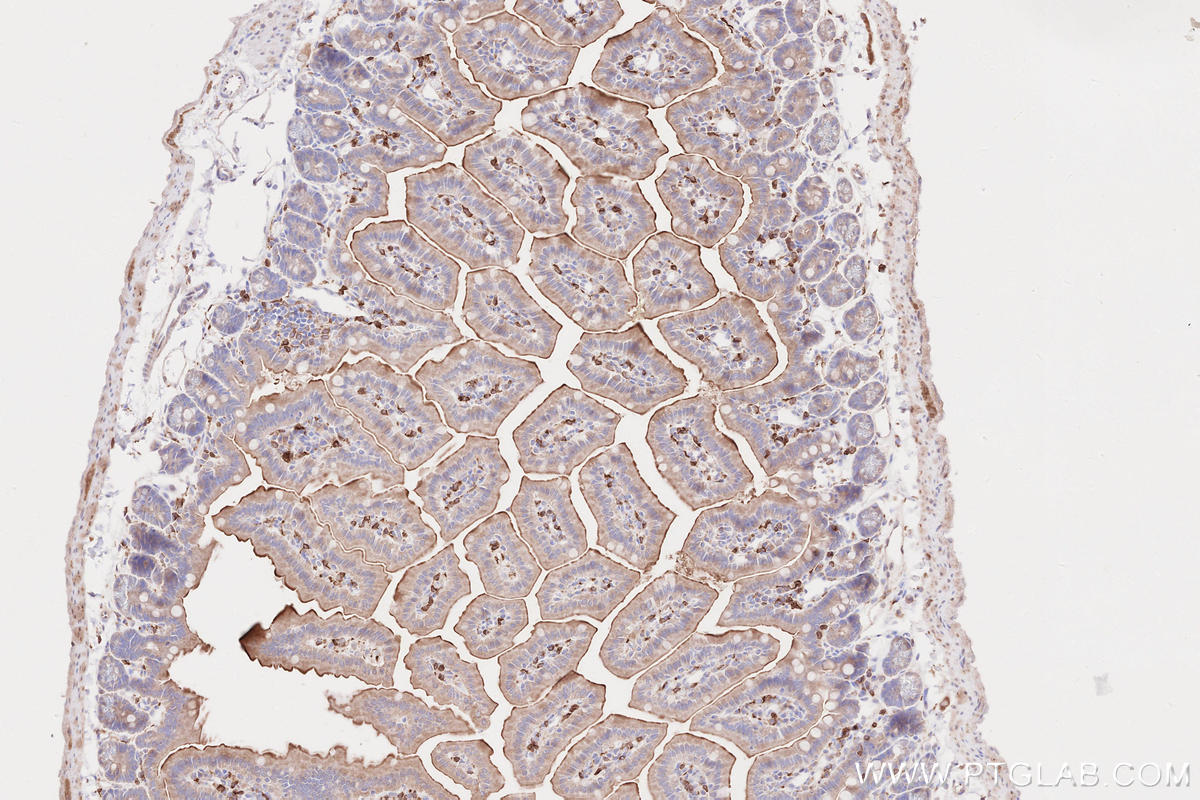 Immunohistochemistry (IHC) staining of mouse small intestine tissue using LPCAT2 Polyclonal antibody (15082-1-AP)