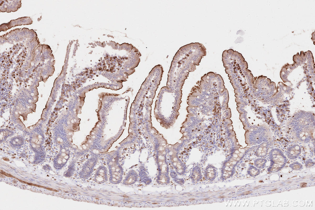 Immunohistochemistry (IHC) staining of rat small intestine tissue using LPCAT2 Polyclonal antibody (15082-1-AP)