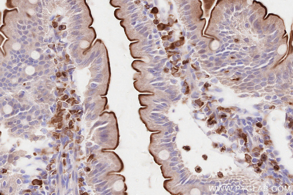 Immunohistochemistry (IHC) staining of rat small intestine tissue using LPCAT2 Polyclonal antibody (15082-1-AP)