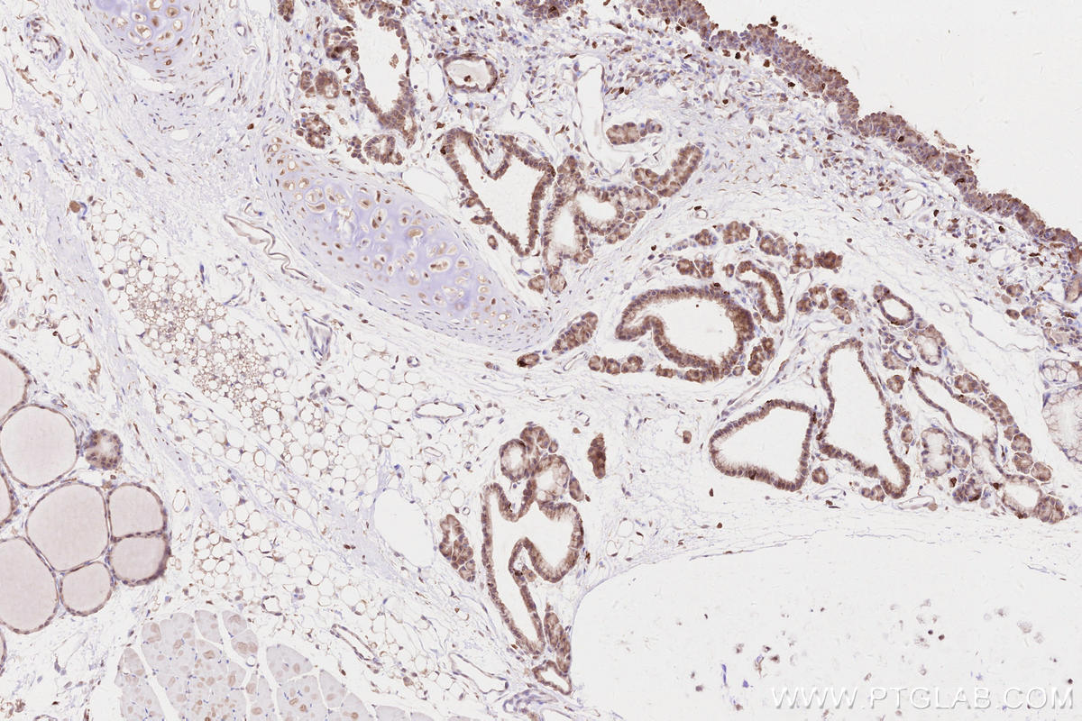 Immunohistochemistry (IHC) staining of rat thyroid gland tissue using LPCAT2 Polyclonal antibody (15082-1-AP)