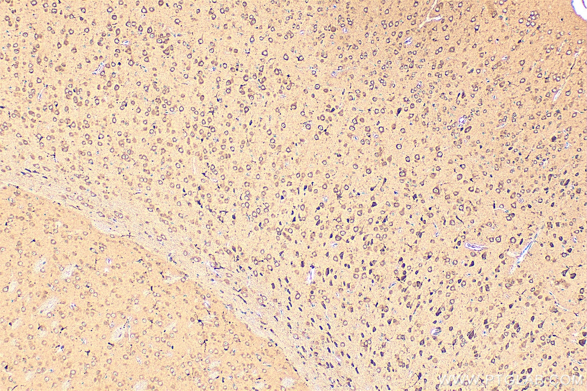 Immunohistochemistry (IHC) staining of mouse brain tissue using LPCAT2 Polyclonal antibody (15082-1-AP)