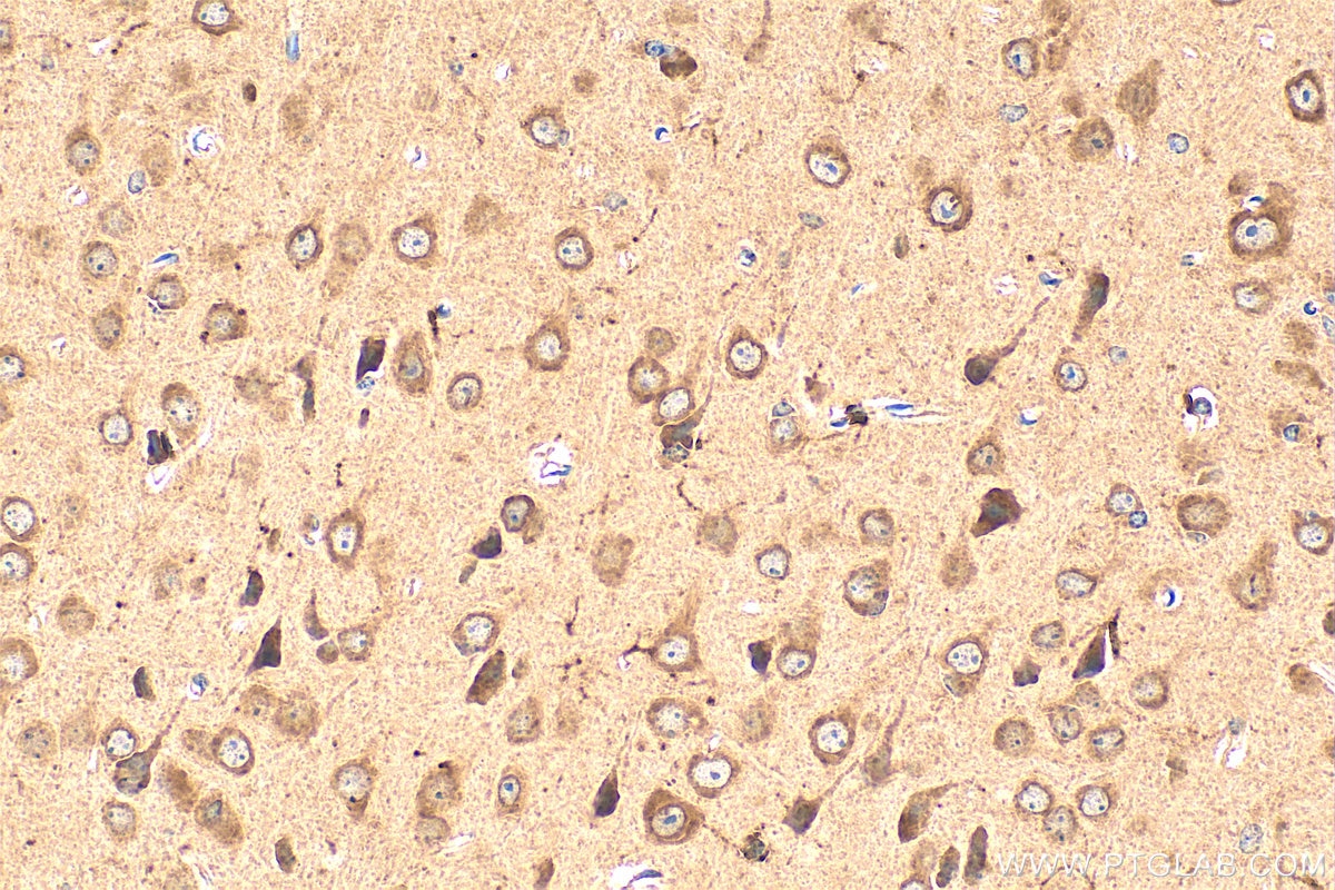 Immunohistochemistry (IHC) staining of mouse brain tissue using LPCAT2 Polyclonal antibody (15082-1-AP)