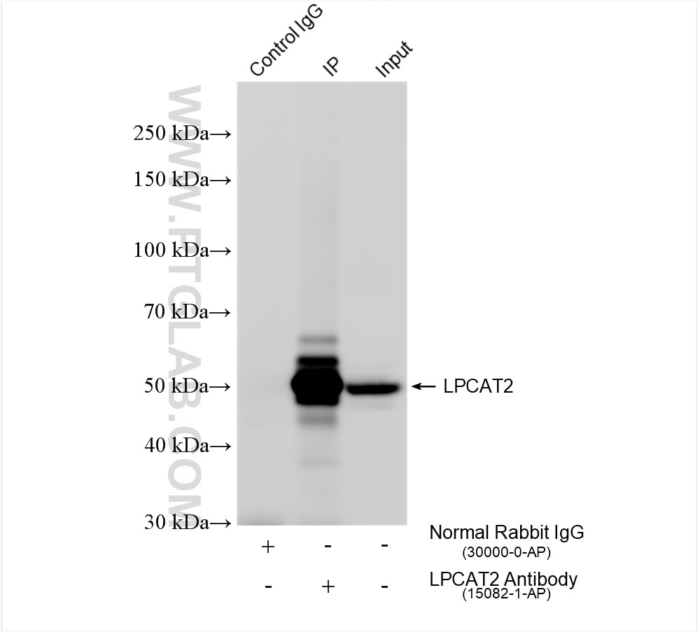 Immunoprecipitation (IP) experiment of HeLa cells using LPCAT2 Polyclonal antibody (15082-1-AP)