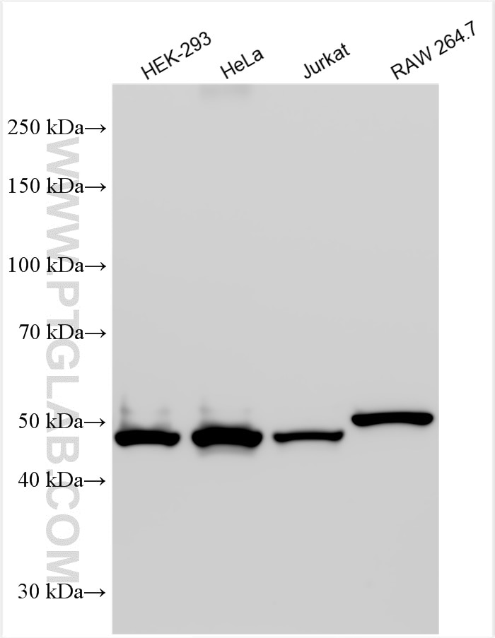 Western Blot (WB) analysis of various lysates using LPCAT2 Polyclonal antibody (15082-1-AP)