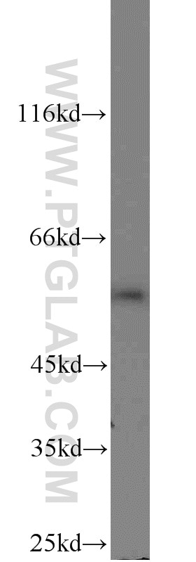 Western Blot (WB) analysis of LPS treated HEK-293 using LPCAT2 Polyclonal antibody (15082-1-AP)