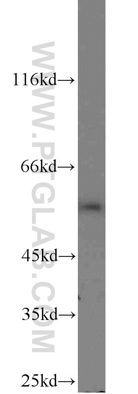 WB analysis of LPS treated HEK-293 using 15082-1-AP