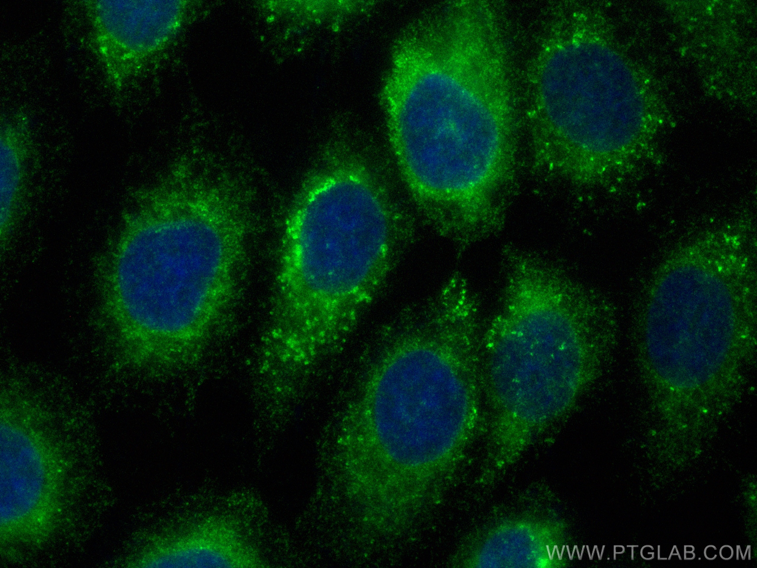 Immunofluorescence (IF) / fluorescent staining of A431 cells using CoraLite® Plus 488-conjugated LPCAT2 Polyclonal an (CL488-15082)
