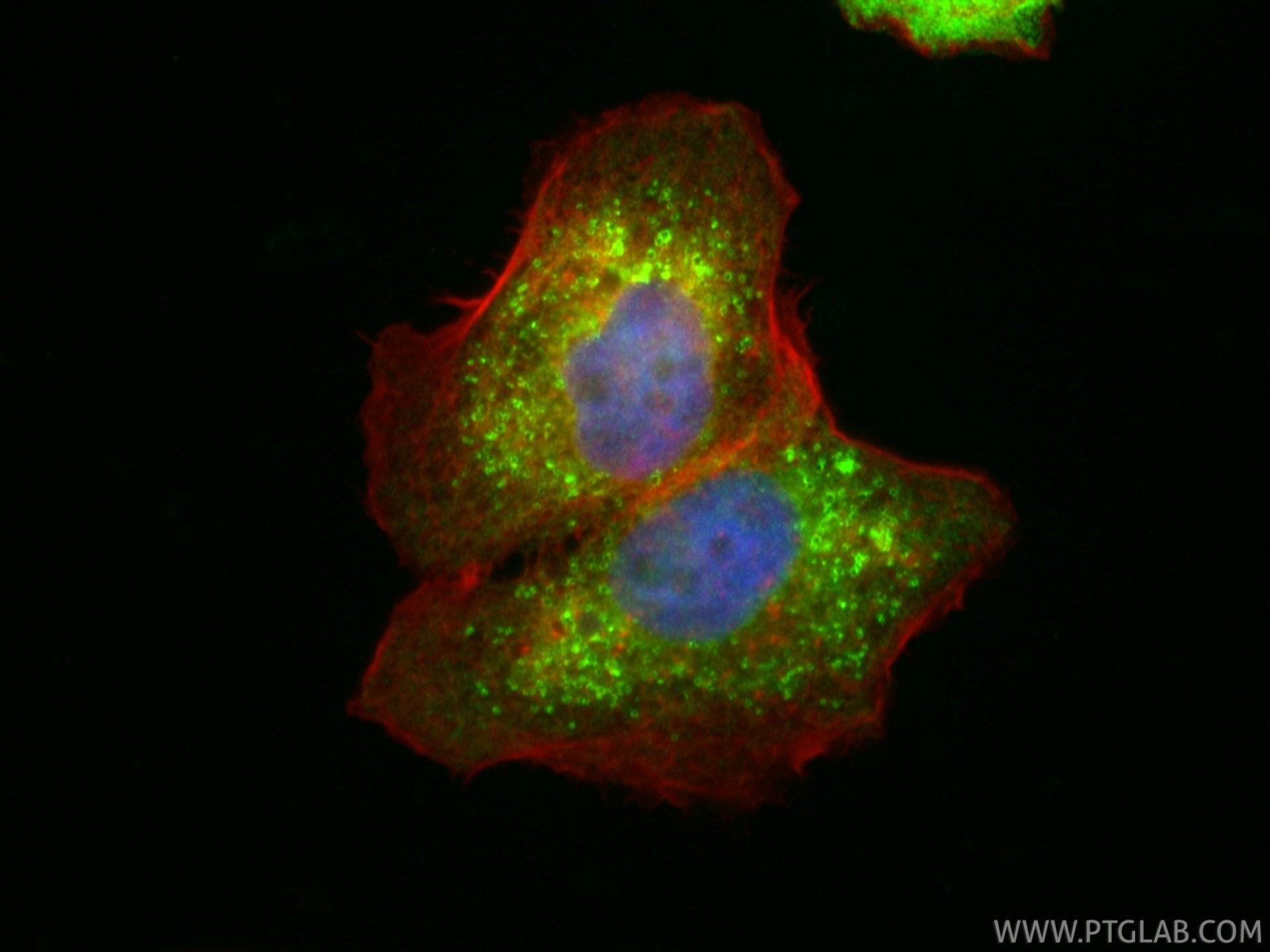 Immunofluorescence (IF) / fluorescent staining of A431 cells using CoraLite® Plus 488-conjugated LPCAT2 Polyclonal an (CL488-15082)