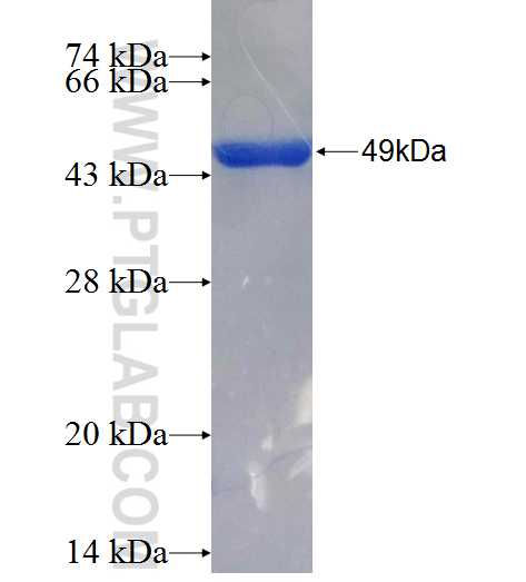 LPCAT2 fusion protein Ag26411 SDS-PAGE