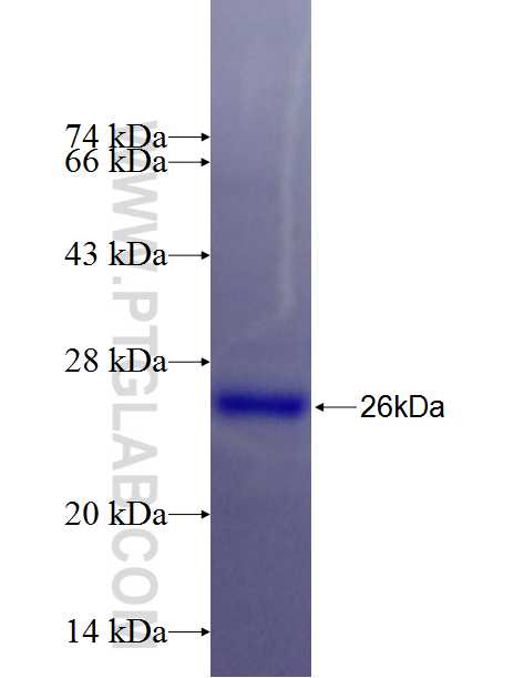 LPCAT2 fusion protein Ag26420 SDS-PAGE