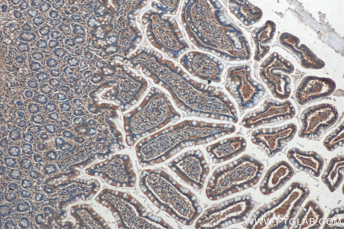 Immunohistochemistry (IHC) staining of human small intestine tissue using LPCAT3 Monoclonal antibody (67882-1-Ig)
