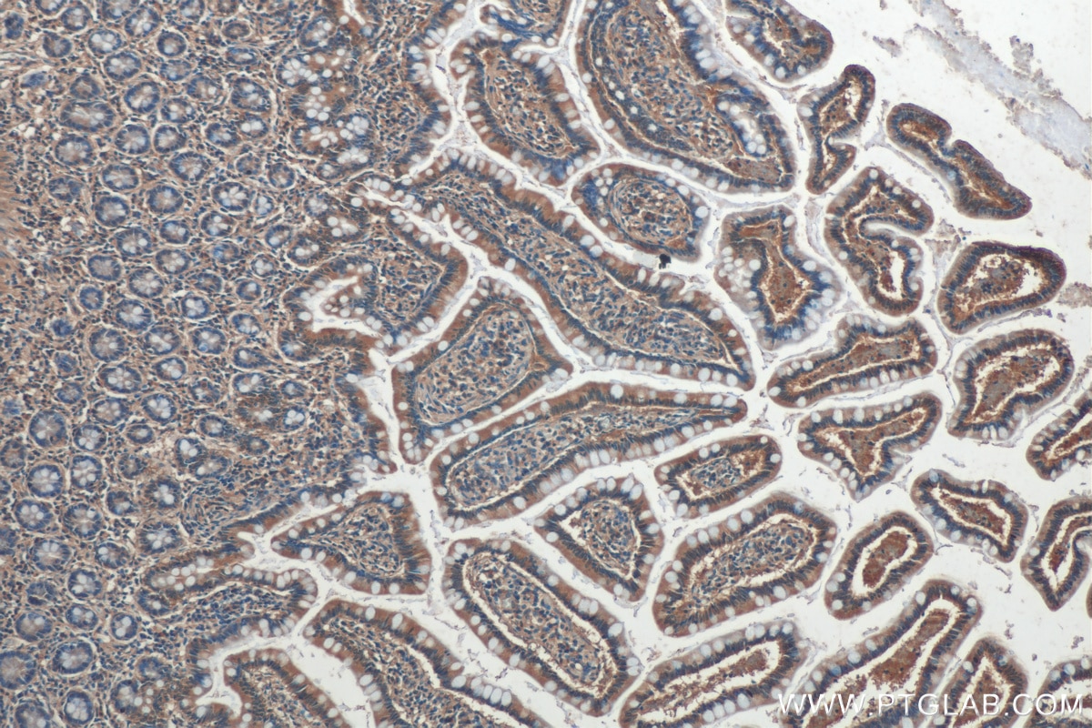 IHC staining of human small intestine using 67882-1-Ig