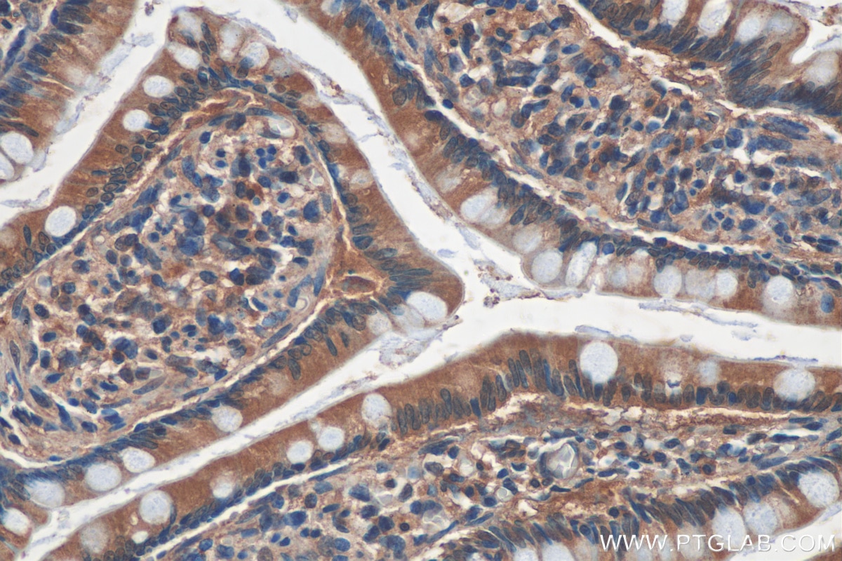 Immunohistochemistry (IHC) staining of human small intestine tissue using LPCAT3 Monoclonal antibody (67882-1-Ig)