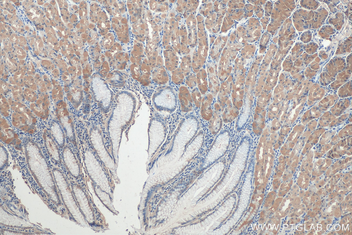 Immunohistochemistry (IHC) staining of human stomach tissue using LPCAT3 Monoclonal antibody (67882-1-Ig)
