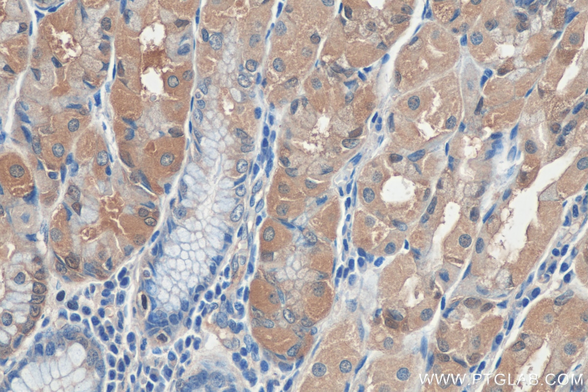 Immunohistochemistry (IHC) staining of human stomach tissue using LPCAT3 Monoclonal antibody (67882-1-Ig)