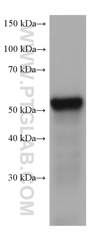 Western Blot (WB) analysis of mouse stomach tissue using LPCAT3 Monoclonal antibody (67882-1-Ig)