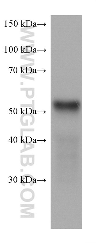 Western Blot (WB) analysis of pig stomach tissue using LPCAT3 Monoclonal antibody (67882-1-Ig)