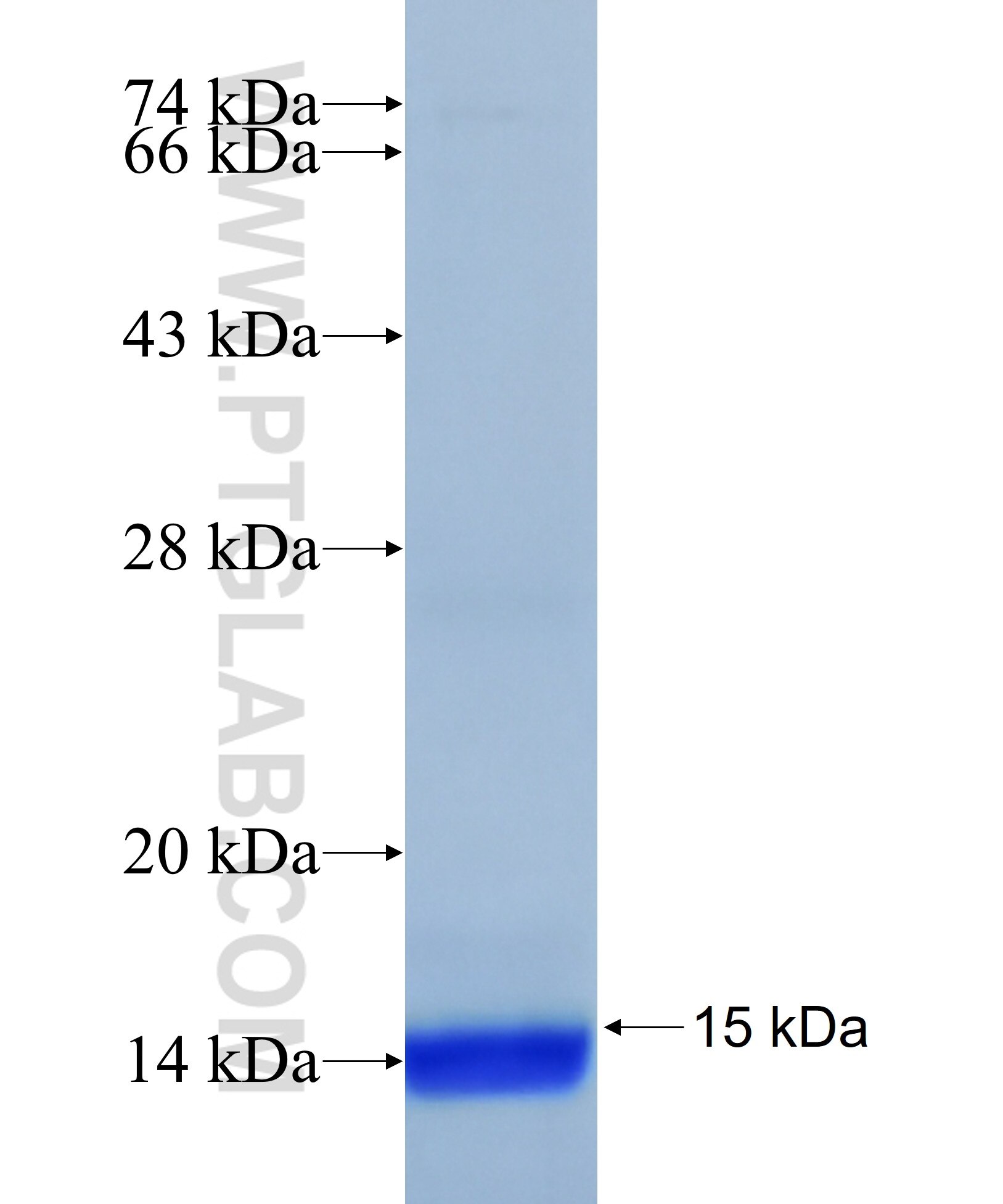 LPCAT3 fusion protein Ag39050 SDS-PAGE LPCAT3 fusion protein Ag39050 SDS-PAGE