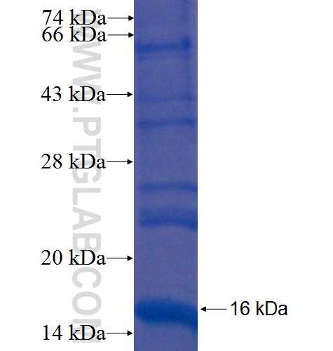 LPCAT3 fusion protein Ag6472 SDS-PAGE