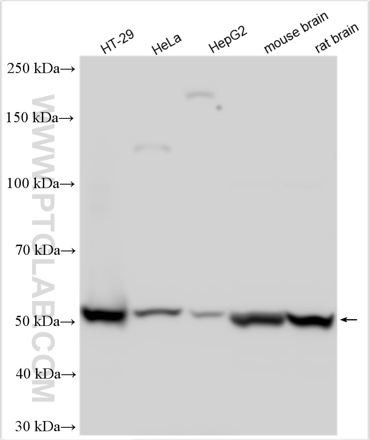 Western Blot (WB) analysis of various lysates using LPCAT4 Polyclonal antibody (17905-1-AP)