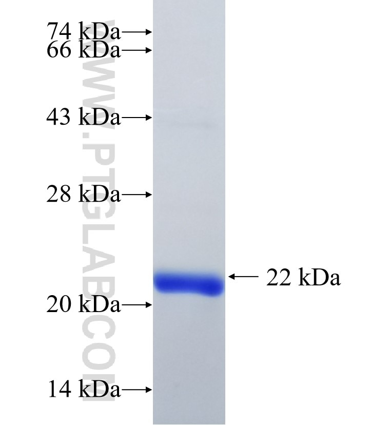 LPCAT4 fusion protein Ag34340 SDS-PAGE LPCAT4 fusion protein Ag34340 SDS-PAGE