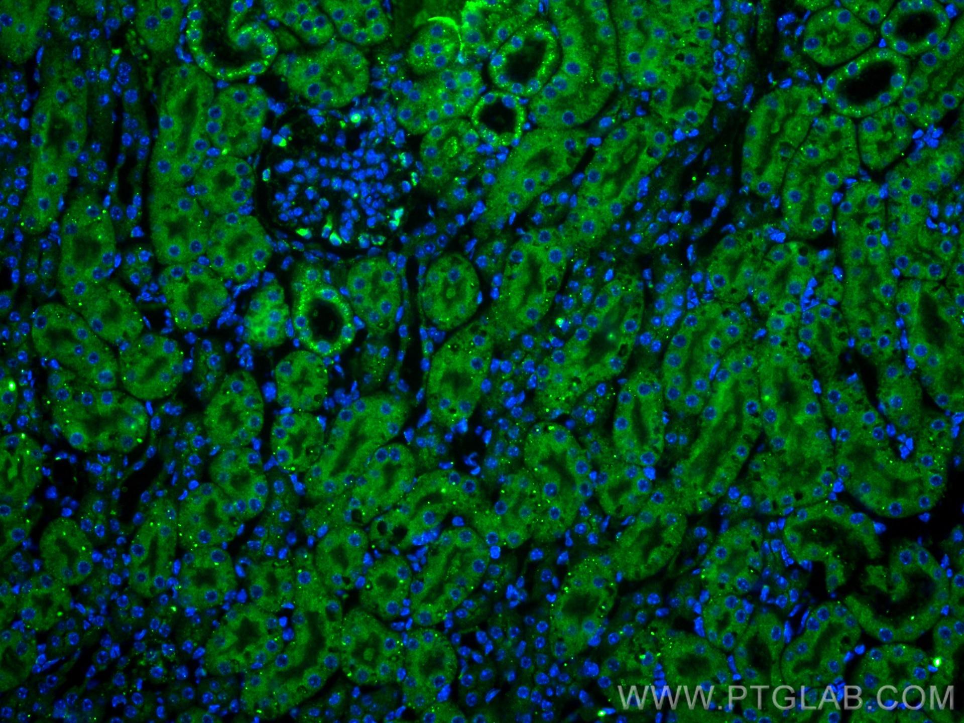 Immunofluorescence (IF) / fluorescent staining of mouse kidney tissue using LPHN1 Polyclonal antibody (30142-1-AP)