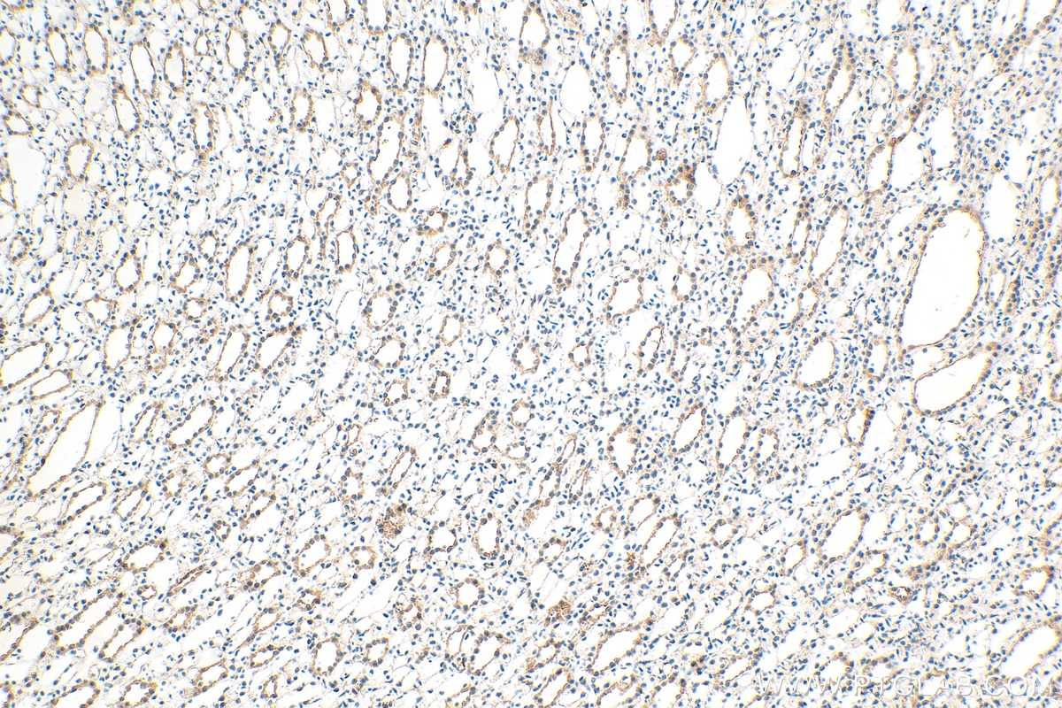 Immunohistochemistry (IHC) staining of rat kidney tissue using LPHN1 Polyclonal antibody (30142-1-AP)