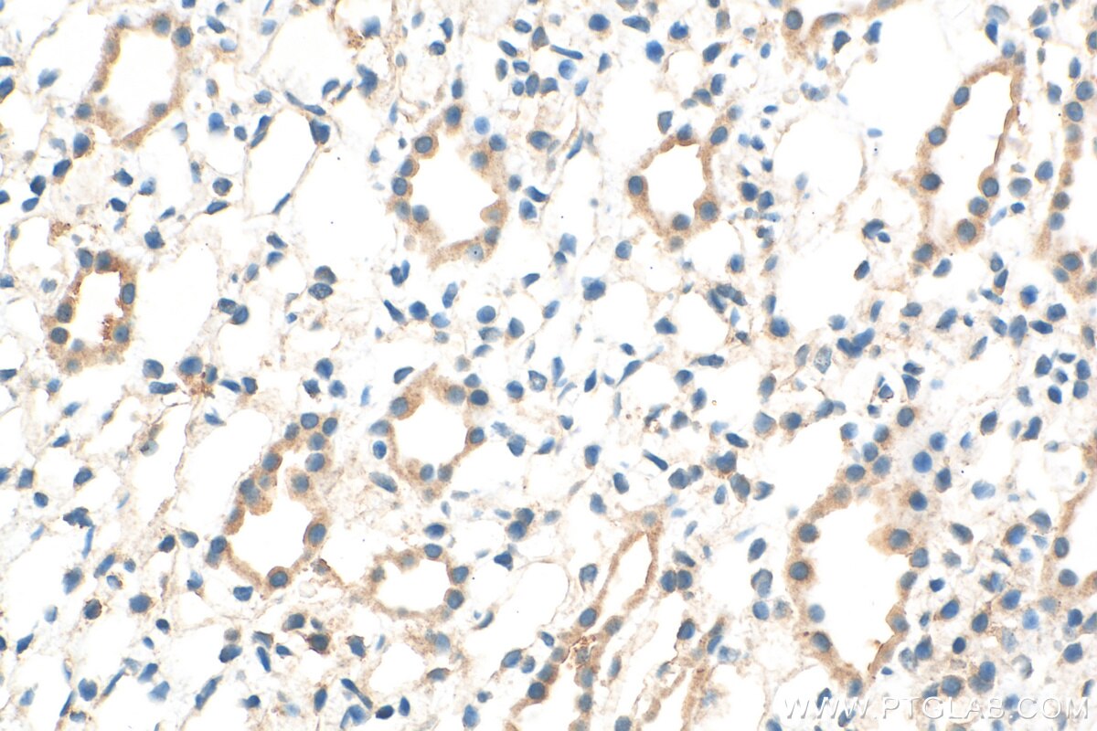 Immunohistochemistry (IHC) staining of rat kidney tissue using LPHN1 Polyclonal antibody (30142-1-AP)