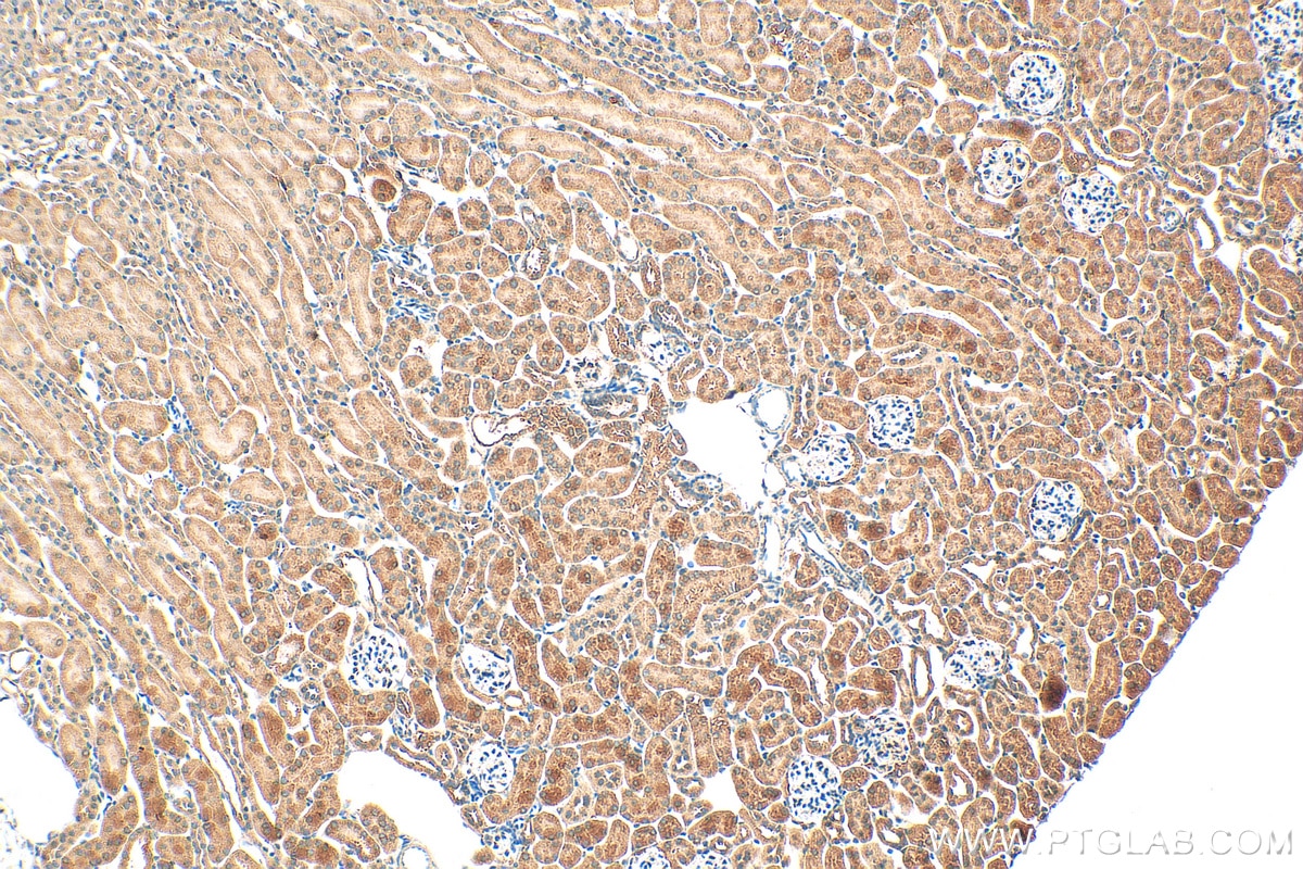 Immunohistochemistry (IHC) staining of mouse kidney tissue using LPHN1 Polyclonal antibody (30142-1-AP)