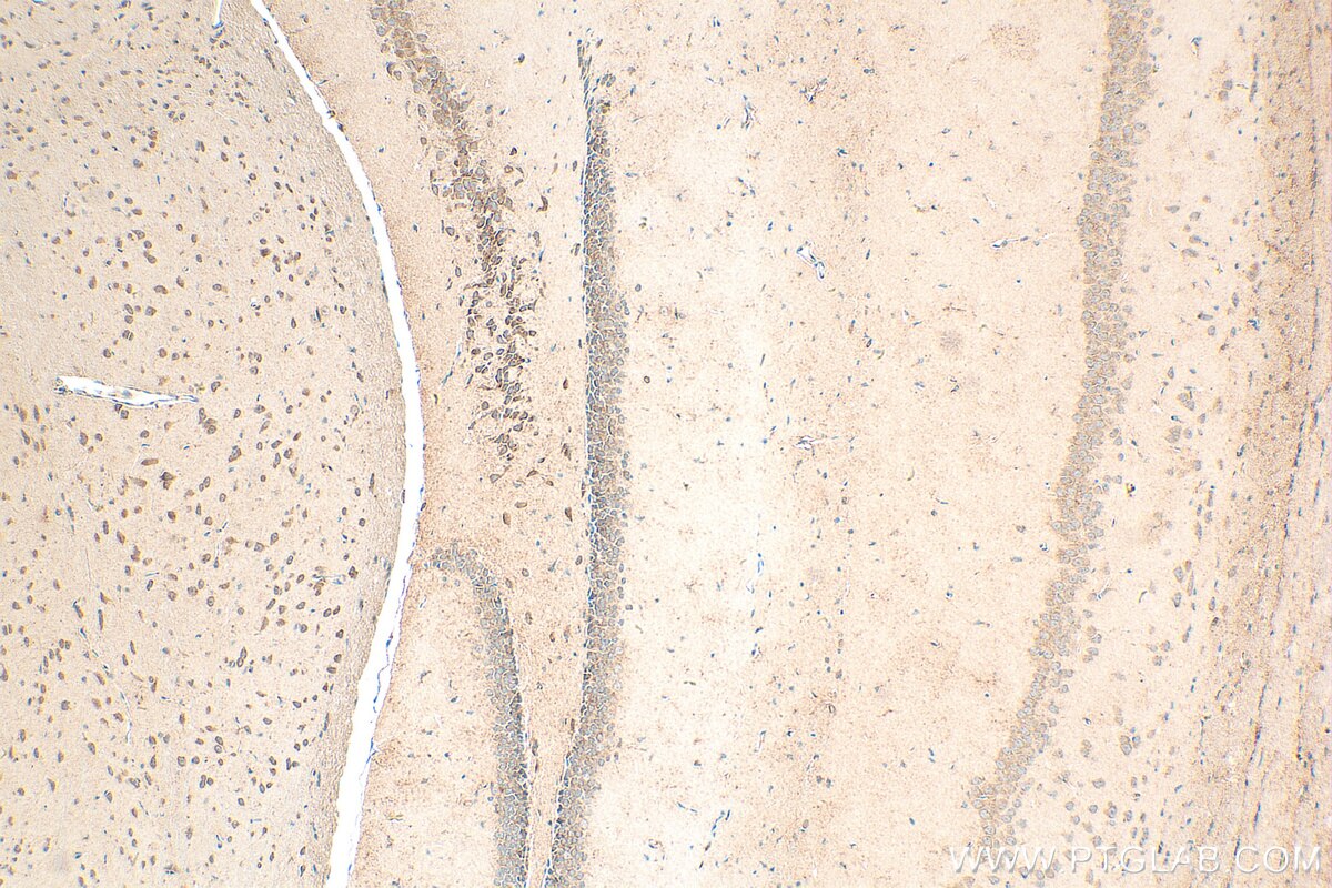 Immunohistochemistry (IHC) staining of mouse brain tissue using LPHN1 Polyclonal antibody (30142-1-AP)