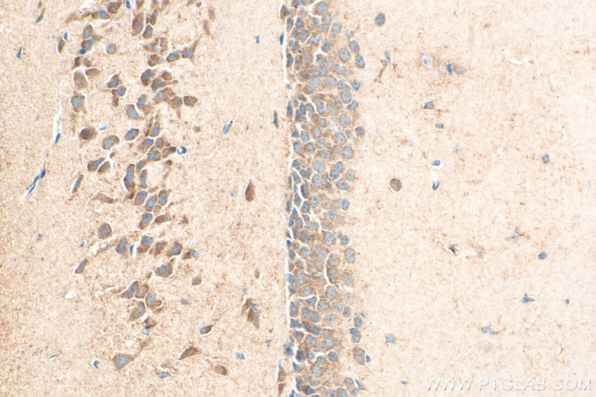 Immunohistochemistry (IHC) staining of mouse brain tissue using LPHN1 Polyclonal antibody (30142-1-AP)