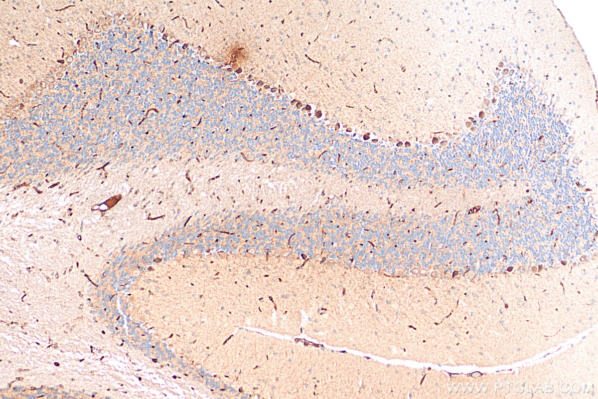 Immunohistochemistry (IHC) staining of mouse cerebellum tissue using LPHN2 Polyclonal antibody (20043-1-AP)