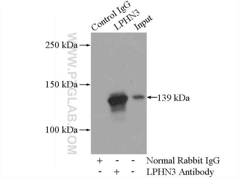 Immunoprecipitation (IP) experiment of mouse brain tissue using LPHN3 Polyclonal antibody (20045-1-AP)