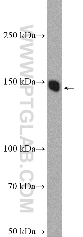 Western Blot (WB) analysis of rat brain tissue using LPHN3 Polyclonal antibody (20045-1-AP)