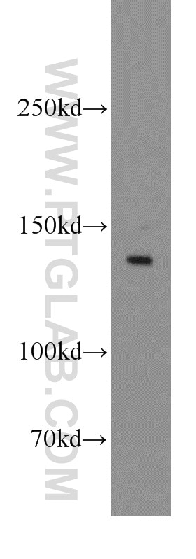 Western Blot (WB) analysis of human liver tissue using LPHN3 Polyclonal antibody (20045-1-AP)