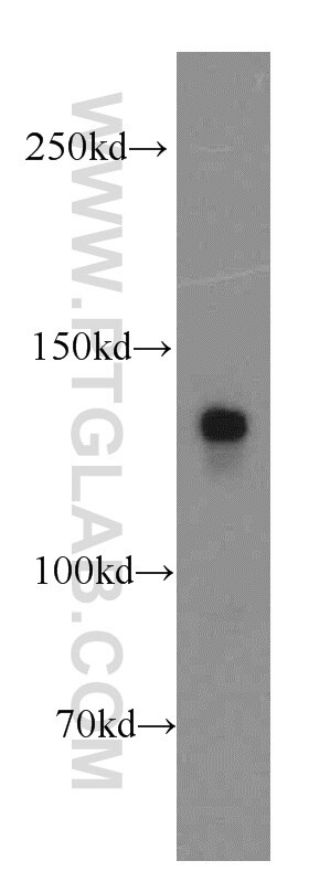 Western Blot (WB) analysis of mouse brain tissue using LPHN3 Polyclonal antibody (20045-1-AP)