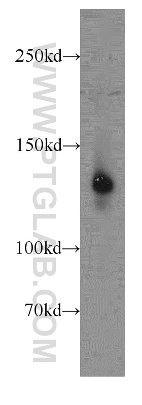 Western Blot (WB) analysis of mouse colon tissue using LPHN3 Polyclonal antibody (20045-1-AP)