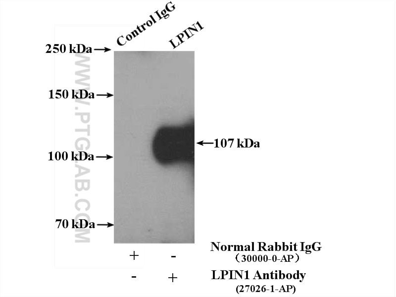 Immunoprecipitation (IP) experiment of LNCaP cells using LPIN1 Polyclonal antibody (27026-1-AP)