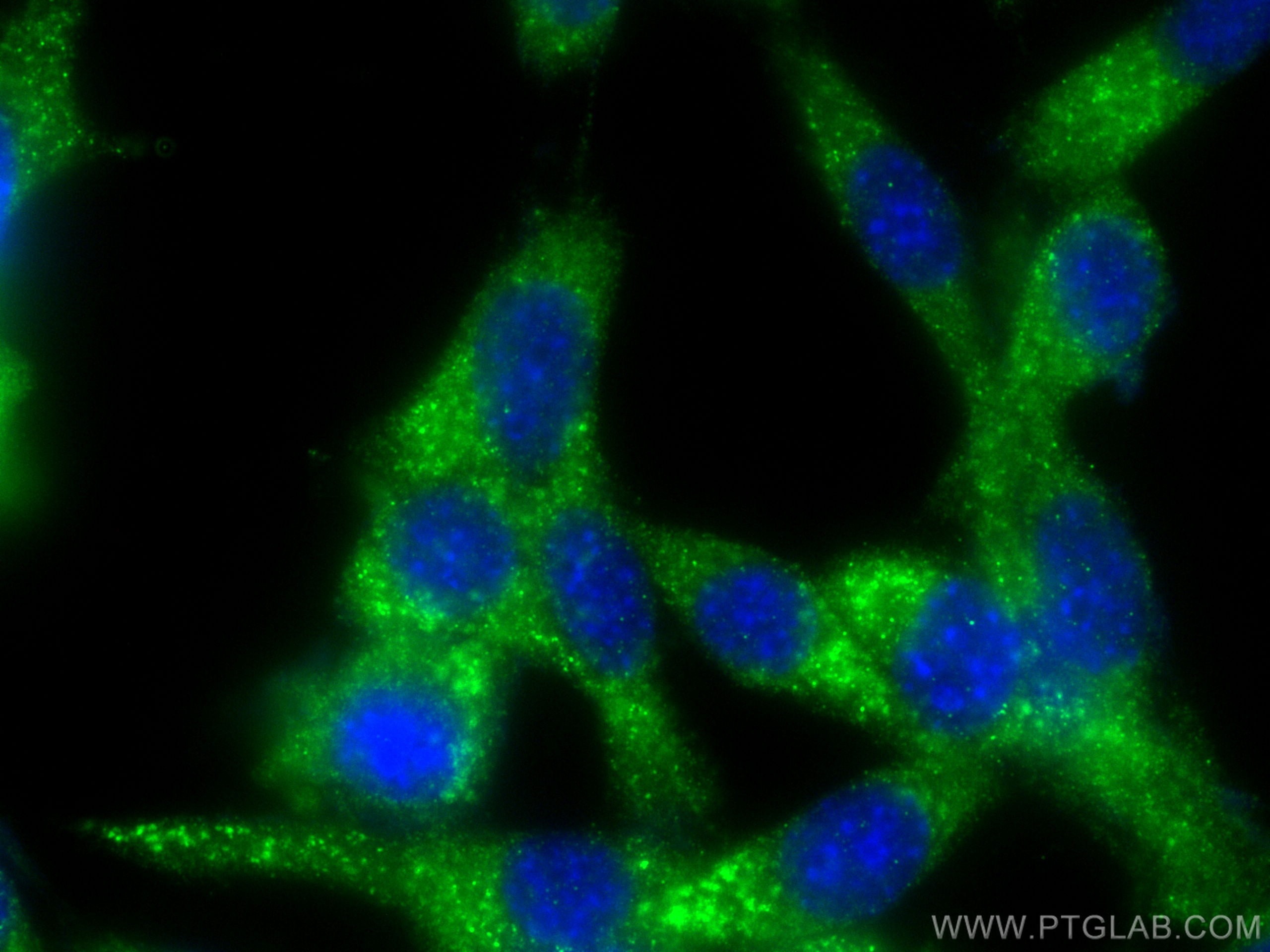 Immunofluorescence (IF) / fluorescent staining of NIH/3T3 cells using LPIN1 Monoclonal antibody (68124-1-Ig)
