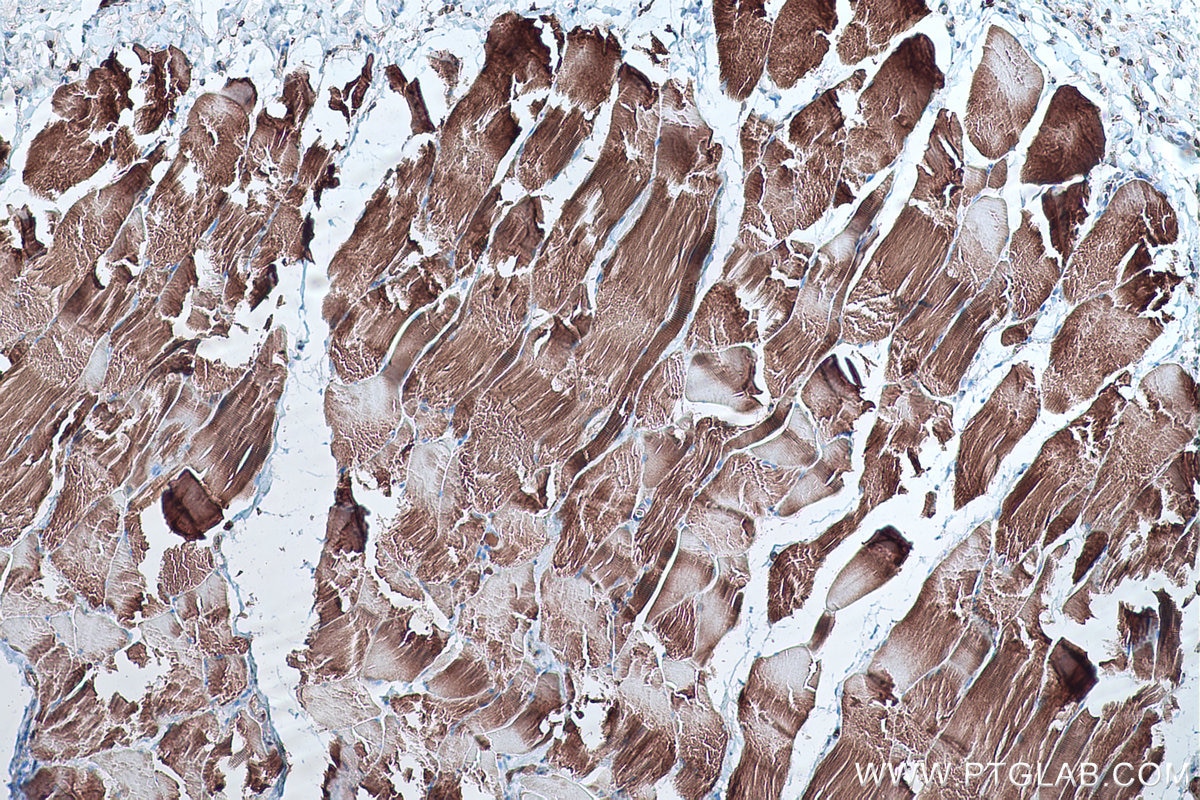 Immunohistochemistry (IHC) staining of rat skeletal muscle tissue using LPIN1 Monoclonal antibody (68124-1-Ig)