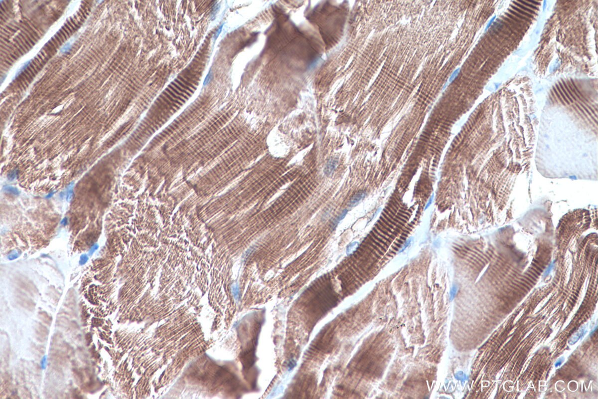 Immunohistochemistry (IHC) staining of rat skeletal muscle tissue using LPIN1 Monoclonal antibody (68124-1-Ig)