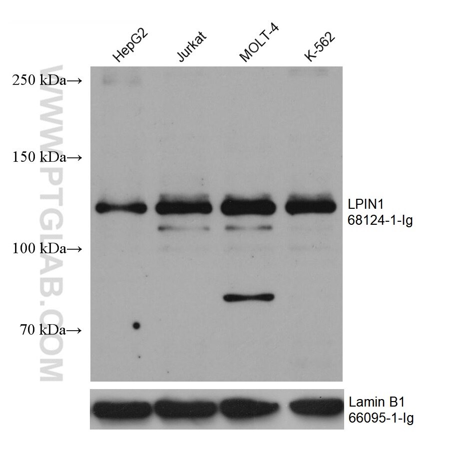 Western Blot (WB) analysis of various lysates using LPIN1 Monoclonal antibody (68124-1-Ig)