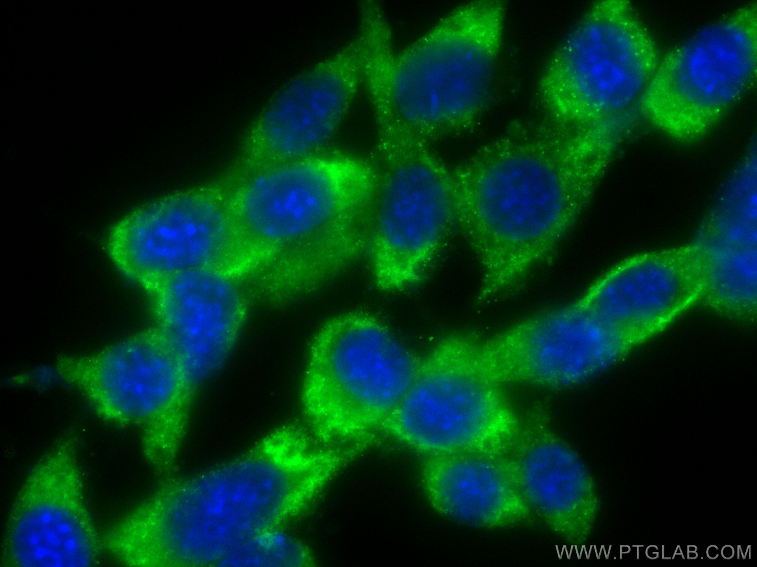 Immunofluorescence (IF) / fluorescent staining of NIH/3T3 cells using CoraLite® Plus 488-conjugated LPIN1 Monoclonal ant (CL488-68124)