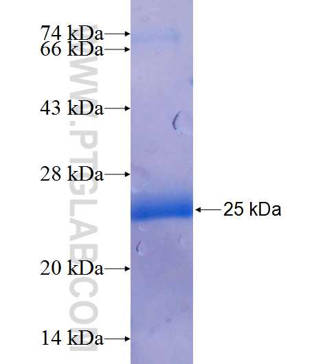 LPIN1 fusion protein Ag25813 SDS-PAGE